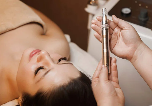 Microneedling for acne scars in san antonio